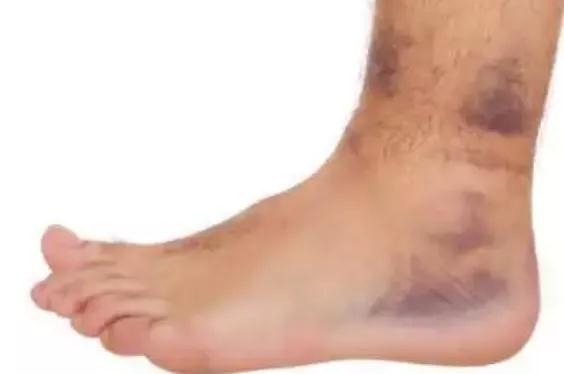 40岁后身体出现这四个信号，说明体内已有癌细胞，别忽视了(图3)