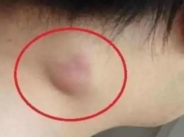 40岁后身体出现这四个信号，说明体内已有癌细胞，别忽视了(图2)