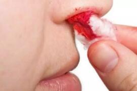 鼻炎会变成鼻咽肿瘤吗?发现以下症状要小心了!(图2)