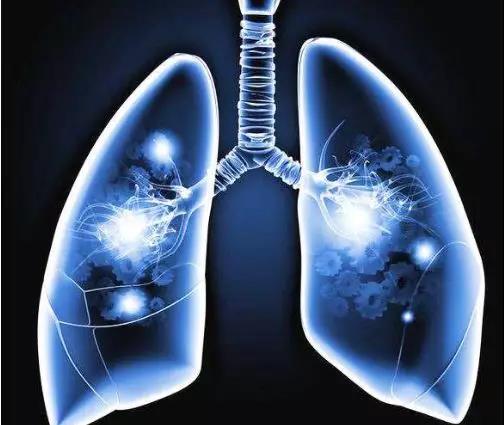 【肿瘤科普】结节、息肉、囊肿、增生,哪个才是肿瘤先兆?(图1)