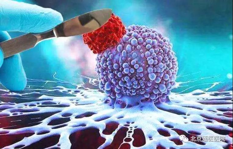 肿瘤是身体“内乱”，别轻易开刀!(图2)