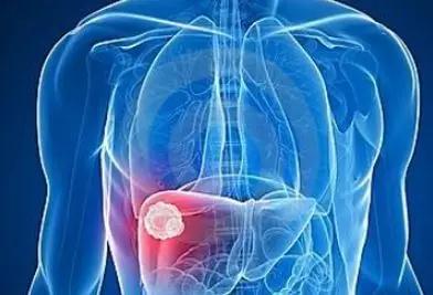 经常洗牙，牙龈还总是出血?可能是肝脏在“求救”(图2)