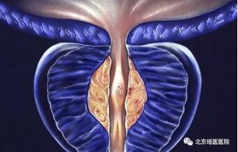 三大肿瘤最爱找上男人，这些习惯很多人都有(图2)