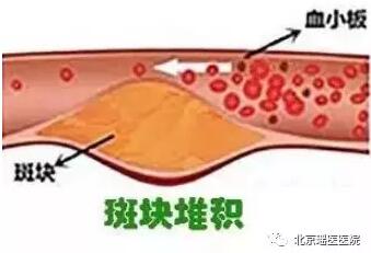 【水是水非】不爱喝水的人，很多都得了这3种病!(图3)